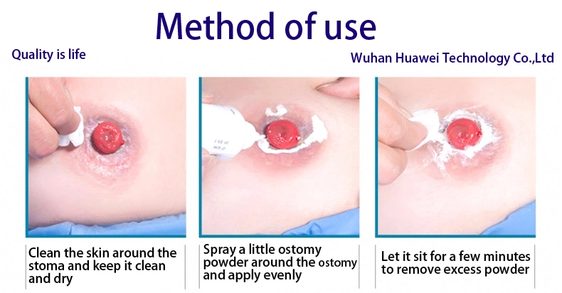 Ostomy Bag Matching Products Ostomy Powder and Skin Care Powder for Stoma